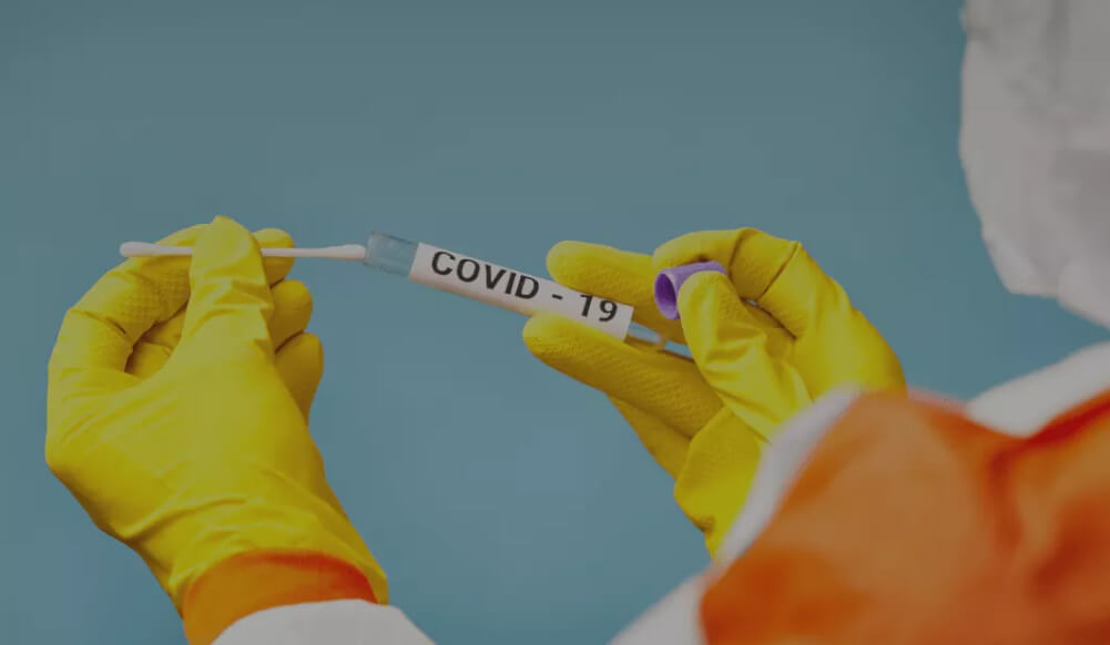 Covid testing Rapid Antigen-10 min